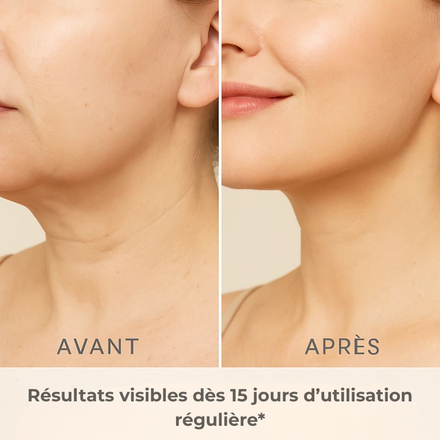 CalmiSculpt : Sculptez et revitalisez votre corps