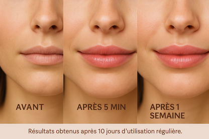 CalmiGlowLip – Solution pour des lèvres hydratées et volumineuses
